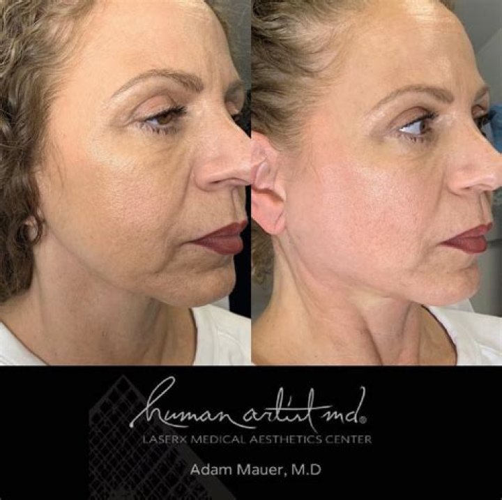 Dr. Adam Mauer, MD – New York, NY