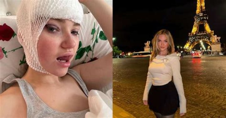 Alyssa Mckay Plastic Surgery Viral On Tiktok: Before And After Photo