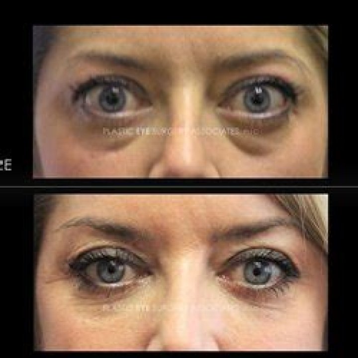 Dr. Charles Soparkar, MD – Houston, TX