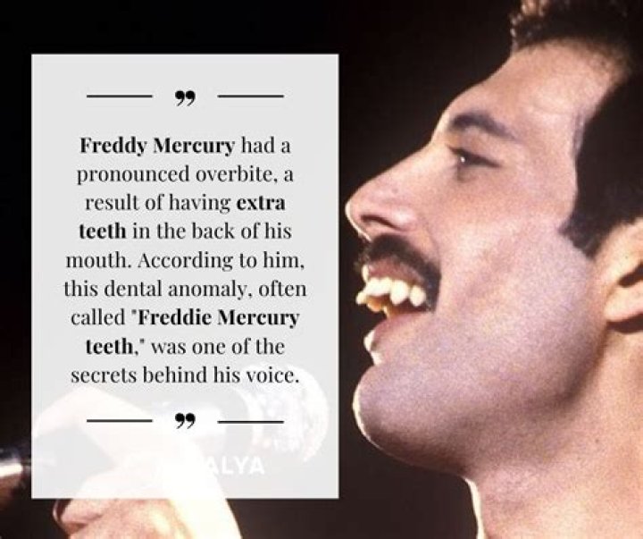 
Freddie Mercury’s Death Cause Confirmed Now? Everything About Singer’s Last Days 