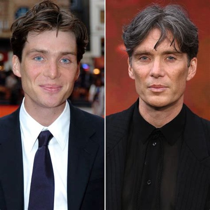 Has Cillian Murphy Had Plastic Surgery? See ‘Oppenheimer’ Star’s Transformation Over the Years