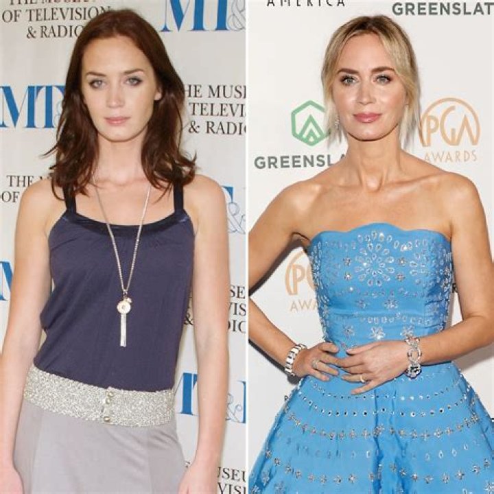 Has Emily Blunt Undergone Plastic Surgery? See the Actress’ Transformation Over the Years