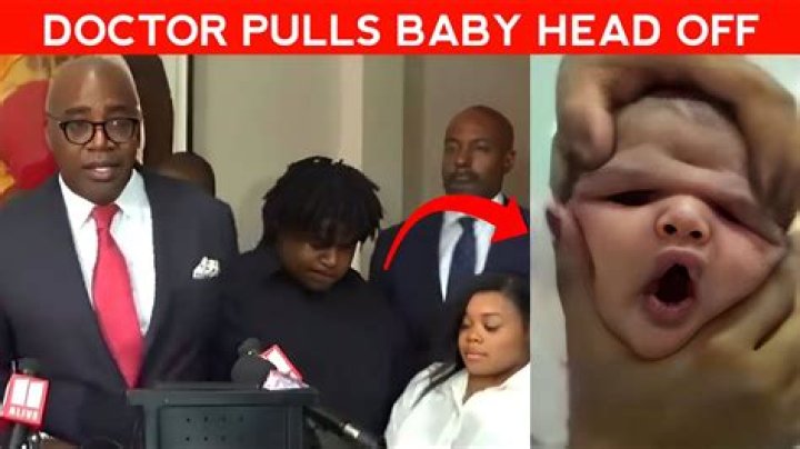 Is Dr. Tracey St Julian Decap Baby?